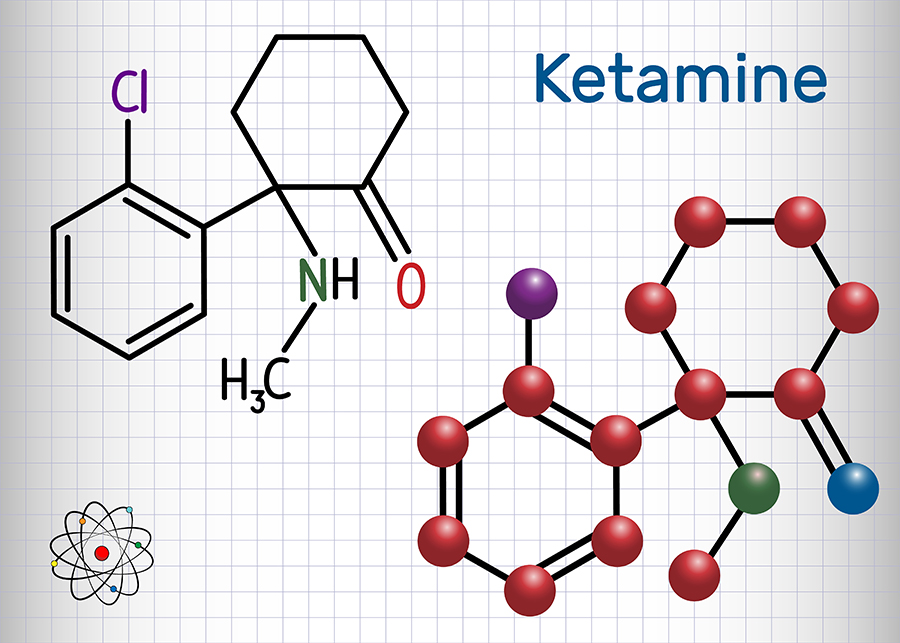 IV Ketamine Infusion Therapy