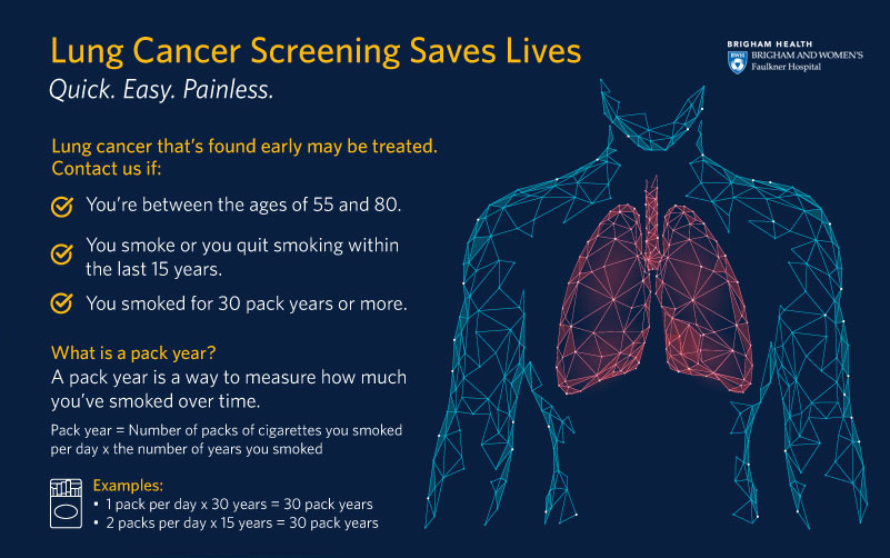 Lung Cancer Screening Infographic
